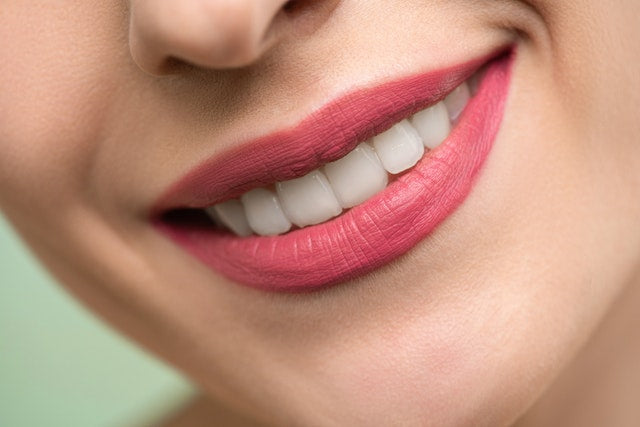 What is Teeth Whitening?